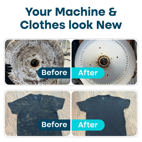 The Uproot Complete Laundry System